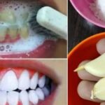 Les bienfaits du bicarbonate de soude + citron
