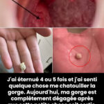 Ce que ces lignes verticales sur vos ongles révèlent réellement