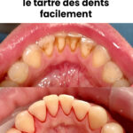 Les 11 meilleurs remèdes à base de miel