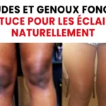 Blanchissez vos dents et éliminez la mauvaise haleine, le tartre et la plaque dentaire avec ce SEUL ingrédient !