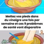 Brioches au lait condensé