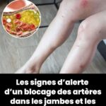Un mois avant mon AVC, mon corps a commencé à me prévenir. Voici les premiers symptômes.